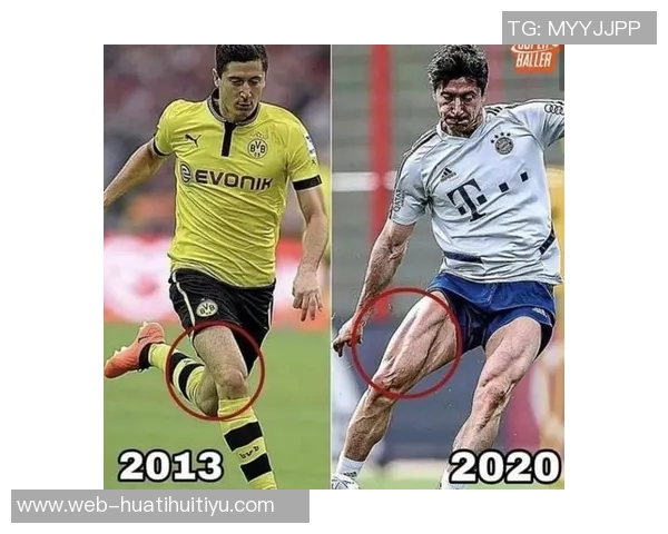 莱万遭遇重伤左大腿肌肉撕裂预计缺阵四到六周